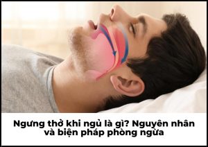 ngưng thở khi ngủ
